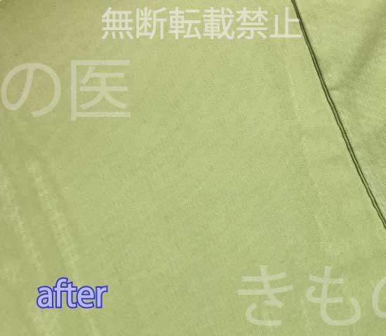 1年前の汗の輪じみの染み抜きクリーニングアフター画像・右胸上部:輪じみが消えています!